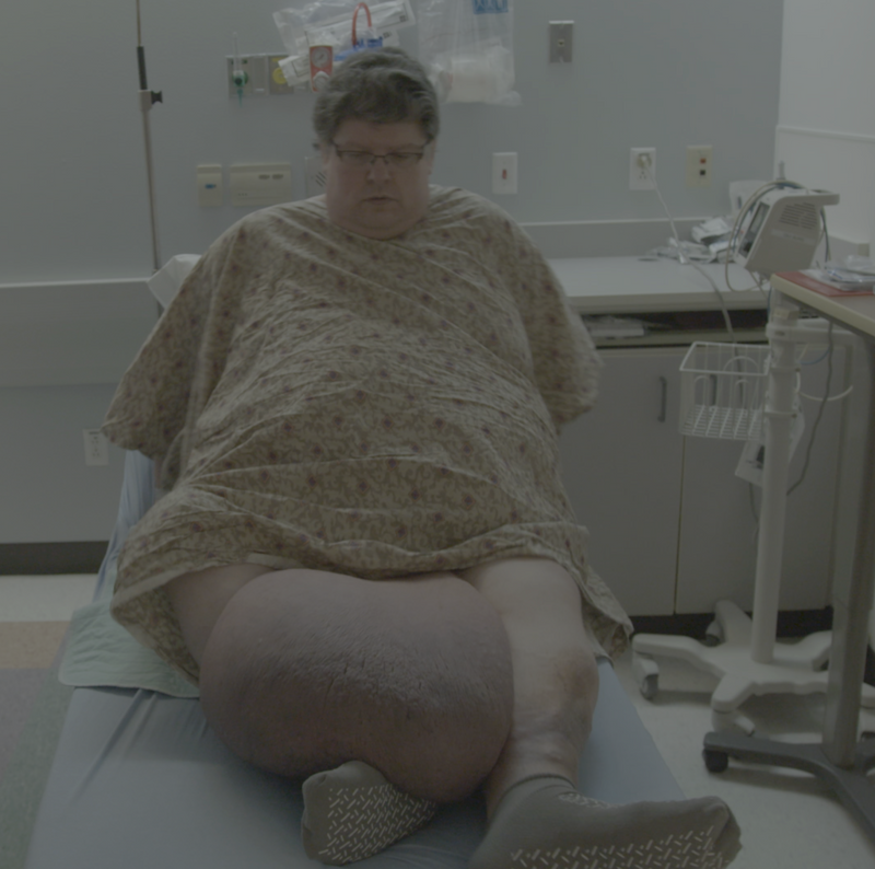 Dr. Now and the 100-Pound Growth